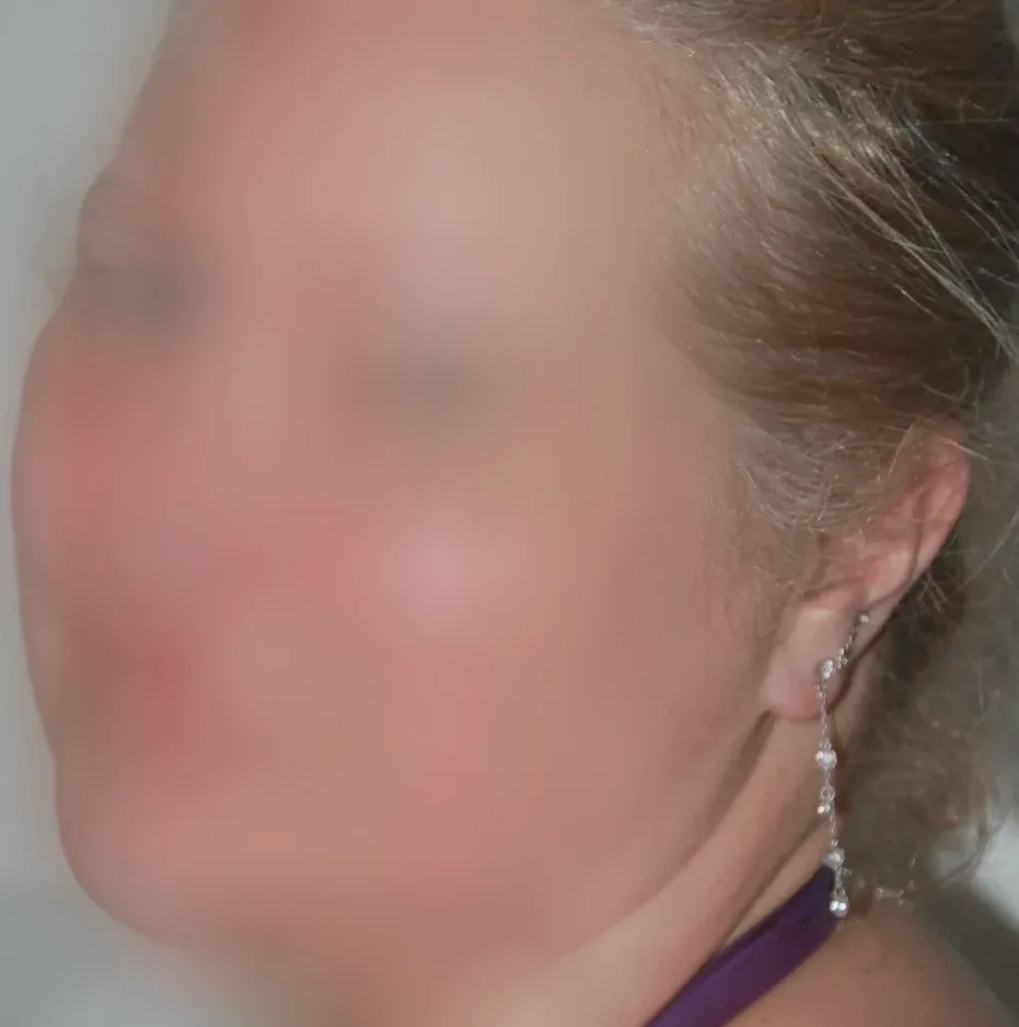 Emily, 28